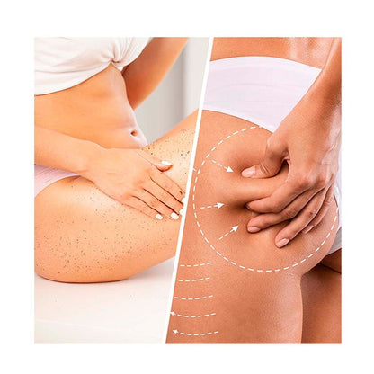 BIOVENE - Gommage Corps Anti-Cellulite Niacin Cellulite Scrub - Espanova Store